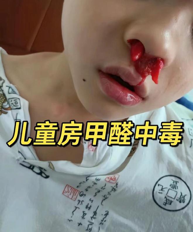 甲醛大户曝光：这些日常用品请立即扔掉不要因为无知祸及全家人(图13)